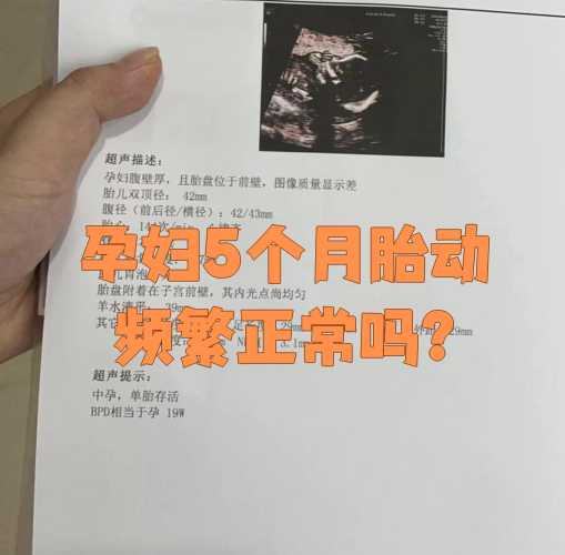 孕五周感觉孕反正常吗-第1张图片