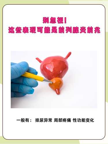 前列腺囊肿会影响备孕吗-第1张图片
