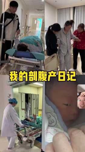 剖腹产要剖腹七层吗-第1张图片