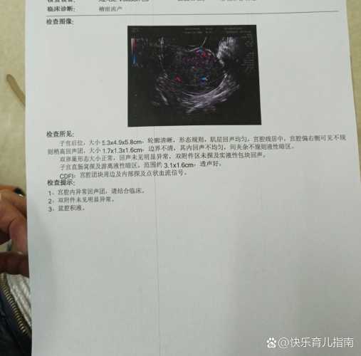 引产后有血块排不出来怎么办-第1张图片