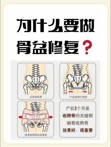 顺产后盆骨痛是怎么回事-第1张图片
