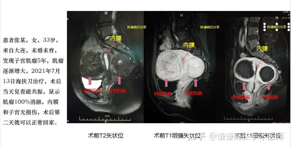 腰疼做核磁共振影响备孕吗-第1张图片