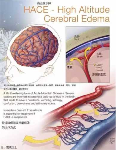 备孕高原反应有哪些症状-第1张图片