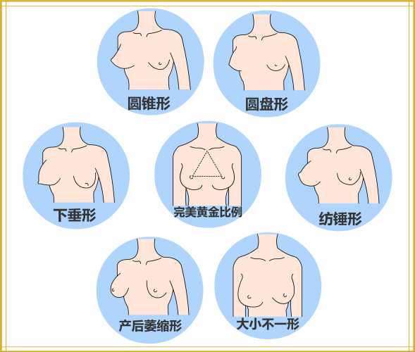 产后2年还能丰胸吗-第1张图片