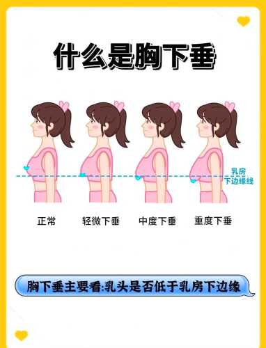 产后胸部下垂如何恢复-第1张图片