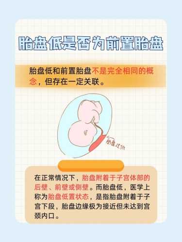胎盘几级可以剖腹产-第1张图片