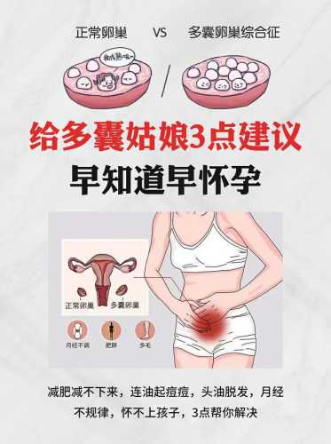多囊女性如何科学备孕-第1张图片