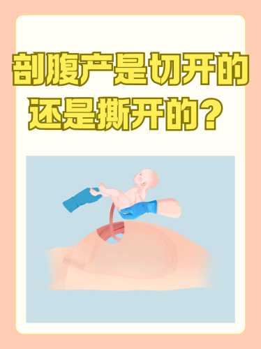 哪里能看二胎剖腹产手术视频-第1张图片