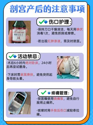剖腹产后咋注意护理事项-第1张图片