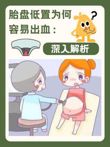 胎盘低能顺产吗-第1张图片