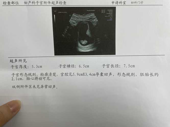 6周5天孕反消失正常吗-第1张图片