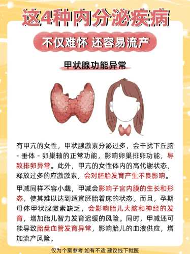 备孕怎么预防妇科病吗-第1张图片