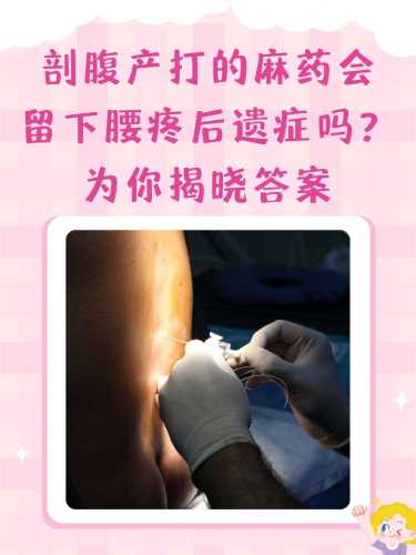 剖腹产不打麻药视频是真的吗-第1张图片