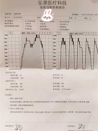 产后检查需要做内检吗-第1张图片