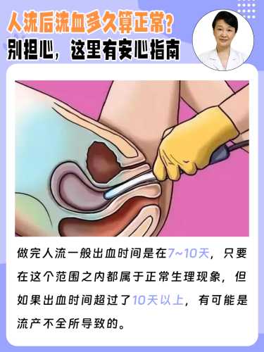 很抱歉，人流是终止妊娠的行为，对女性身体有一定伤害，建议关注身体健康，如有相关健康问题，应咨询专业医生获取科学指导。-第1张图片