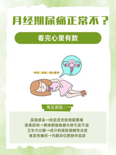 产后尿道口坠痛怎么办-第1张图片