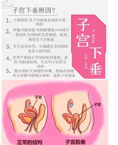 产后子宫发硬正常吗-第1张图片
