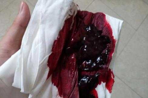 产后两天恶露少正常吗-第1张图片