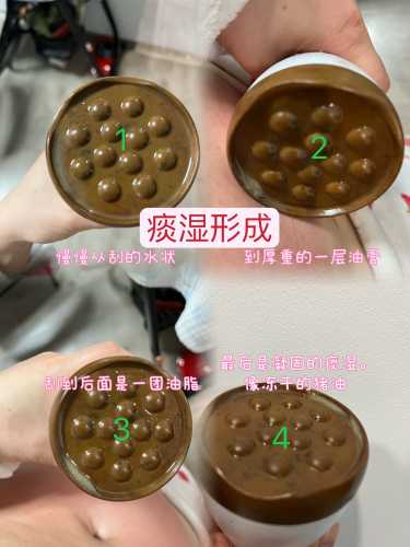 剖腹产痒擦什么-第1张图片