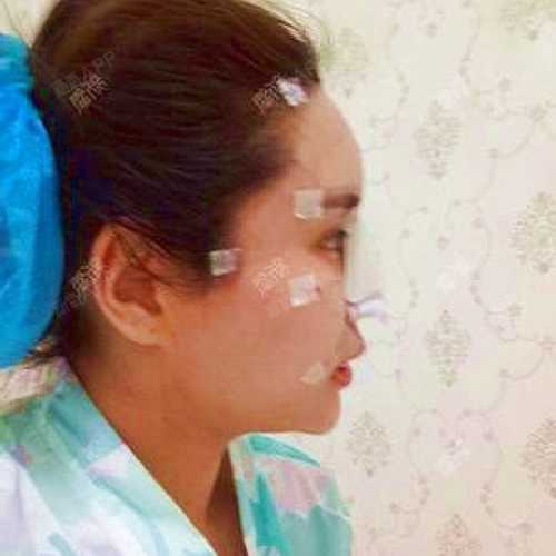 硅胶婴儿有哪些潜在风险呢-第1张图片