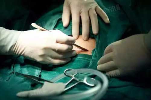 剖腹产后腿麻是否正常-第1张图片