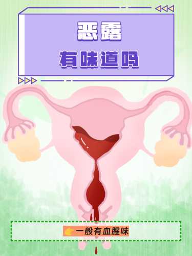 产后11天恶露突然增多咋回事-第1张图片