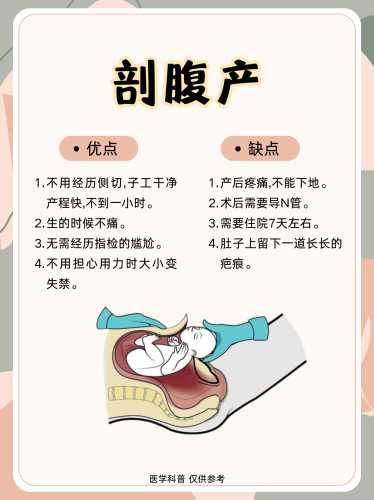 顺产和剖腹产到底怎么选-第1张图片