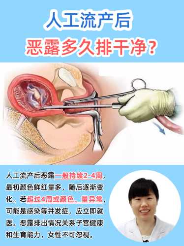 产后恶露多久能排干净-第1张图片