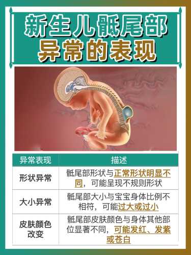 新生儿椎骨发育需注意什么-第1张图片