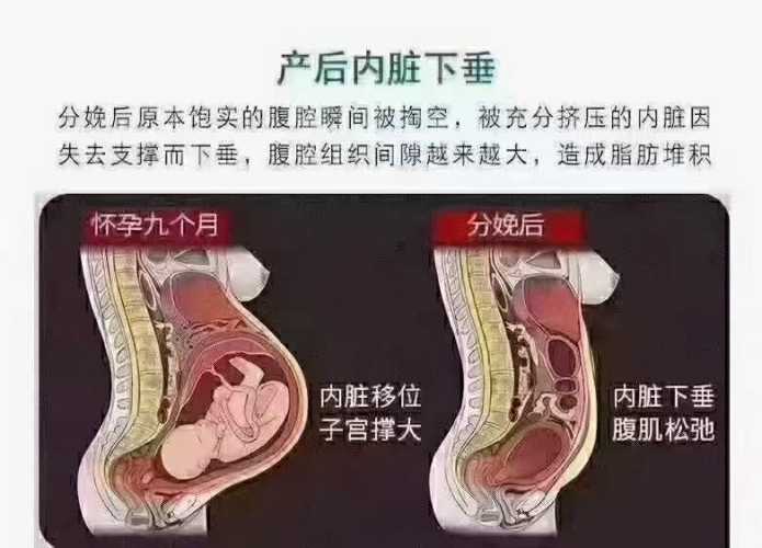 产后子宫恢复不好看什么图-第1张图片