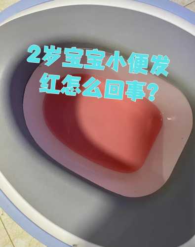 新生儿爱尿怎么回事-第1张图片