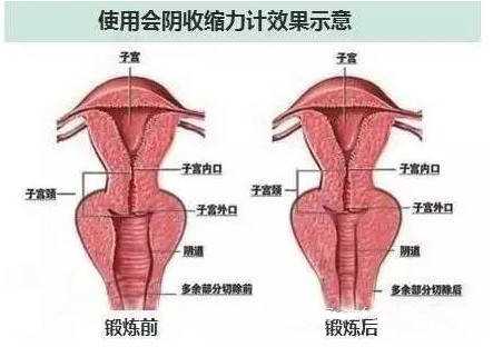 产后阴道红肿怎么办-第1张图片