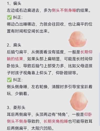 婴儿头型如何塑造才好-第1张图片