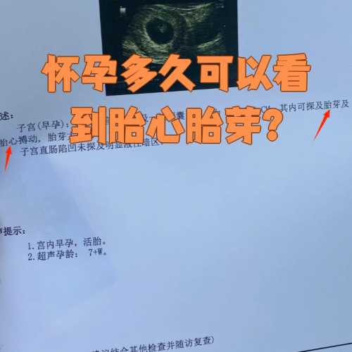 怀孕一个月能查到胎心吗-第1张图片