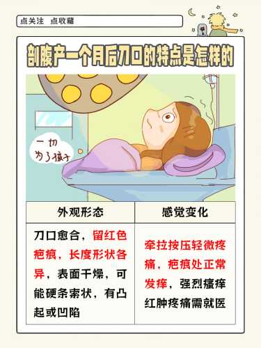 剖腹产牵拉伤口怎么办-第1张图片