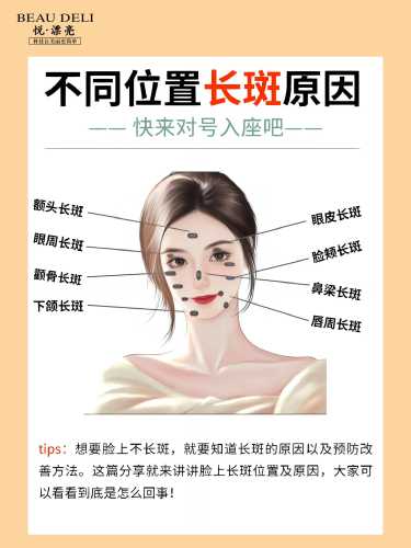 产后脸上长斑的原因是什么-第1张图片