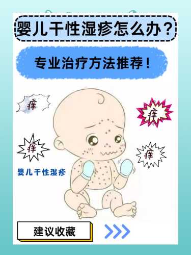 婴儿常见皮肤问题怎么办-第1张图片