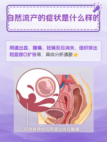 自然流产后需要做月子吗-第1张图片
