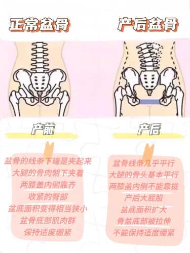 产后盆底检查怎么做-第1张图片