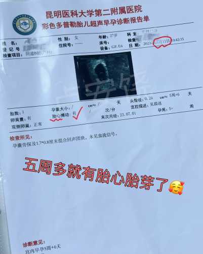做CT后多久可以怀孕-第1张图片