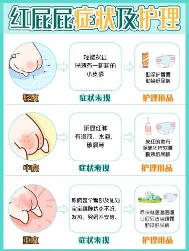 红屁屁尿不湿怎么穿-第1张图片