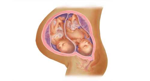 备孕女梦见双胞胎预示什么-第1张图片