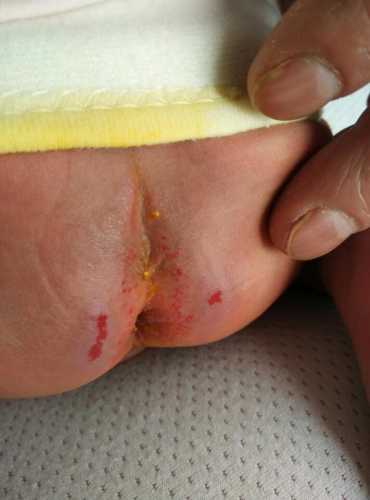 怡儿爽尿不湿好不好用-第1张图片