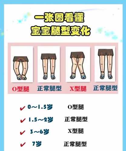 新生儿正常腿型什么样-第1张图片