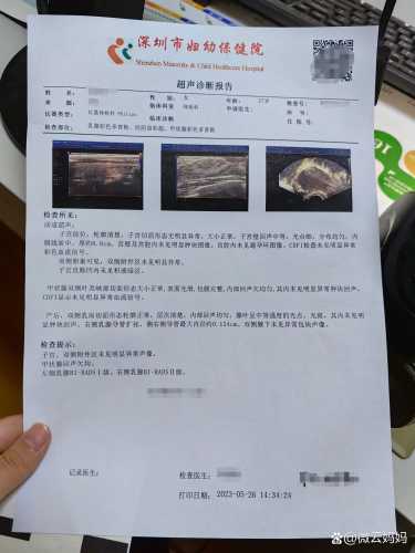 引产后多久能备孕-第1张图片