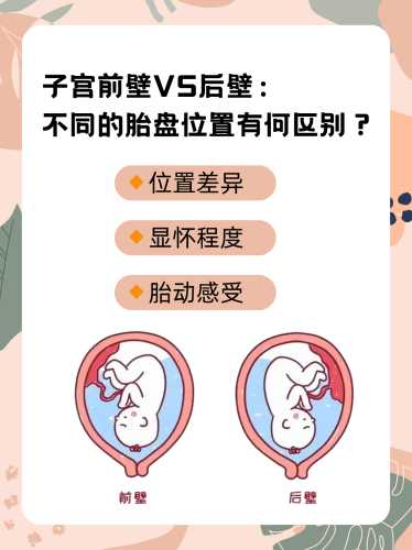 前壁要剖腹产吗-第1张图片