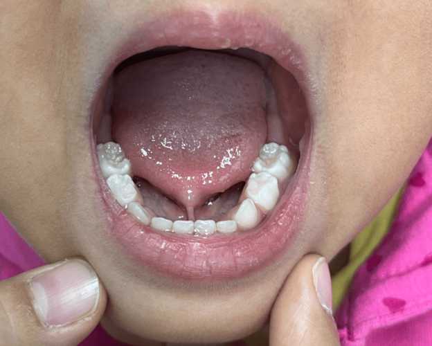 婴儿老是申舌头是怎么回事-第1张图片