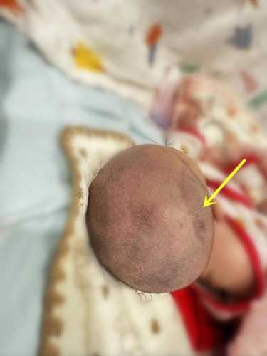 婴儿出生头长多少合适-第1张图片