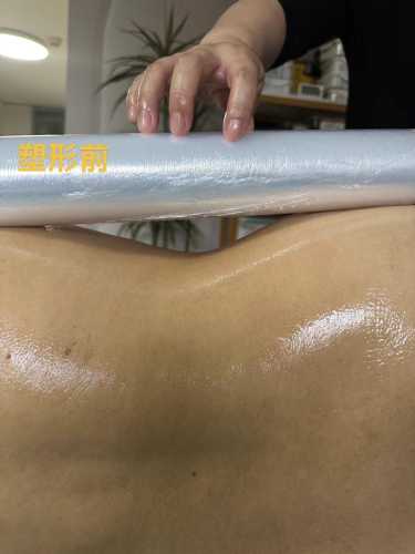 产后塑形加盟前景如何-第1张图片