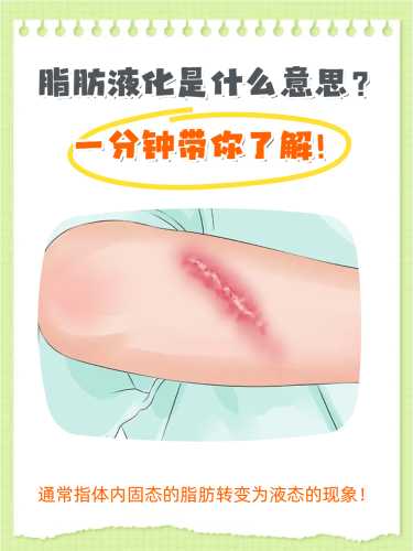 剖腹产出现液化有啥图片-第1张图片
